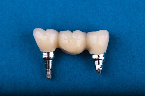 dental implant bridge