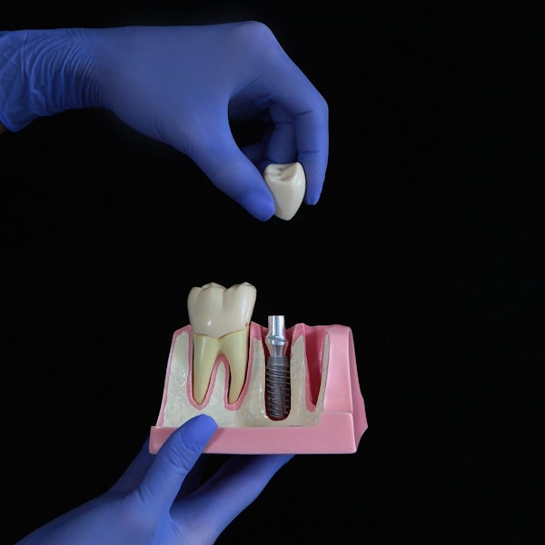 Dental implant crowns