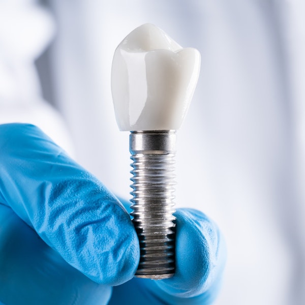 Dental implant