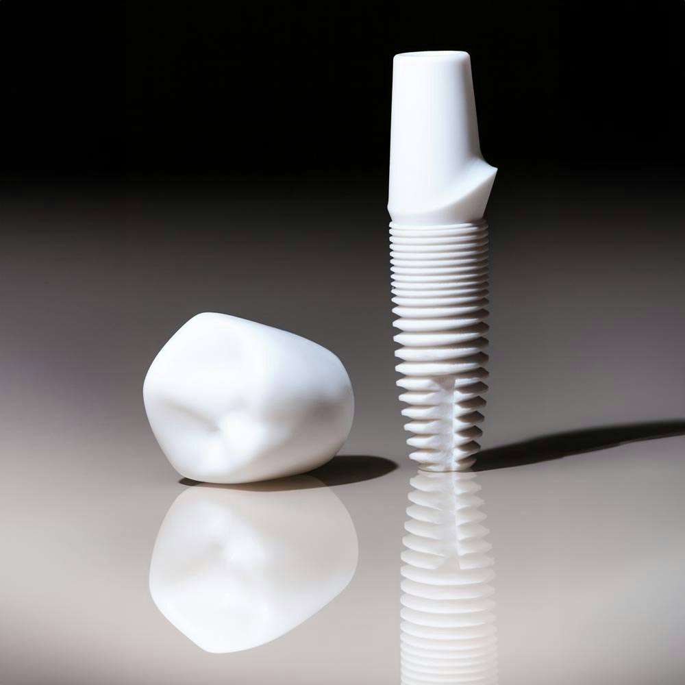 dental implant and crown