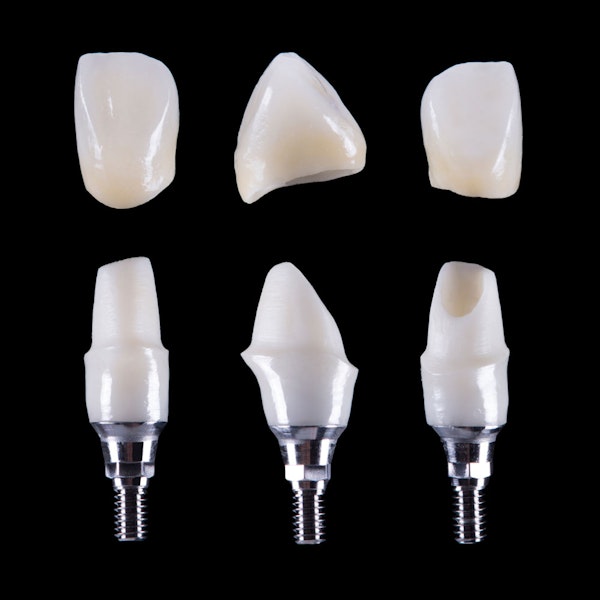 Dental implants