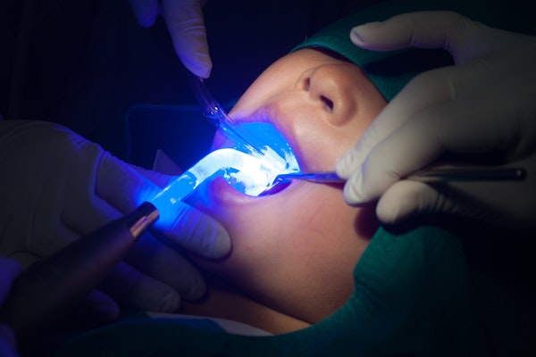 Dental sealants procedure