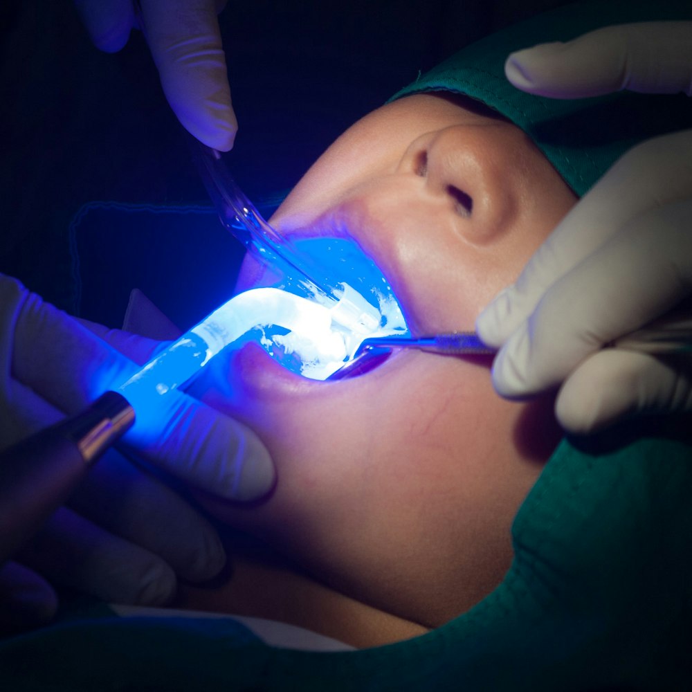 child receiving dental sealant