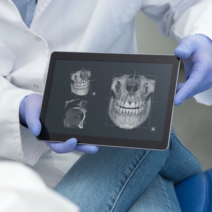 Doctor showing xrays from x-ray scanner