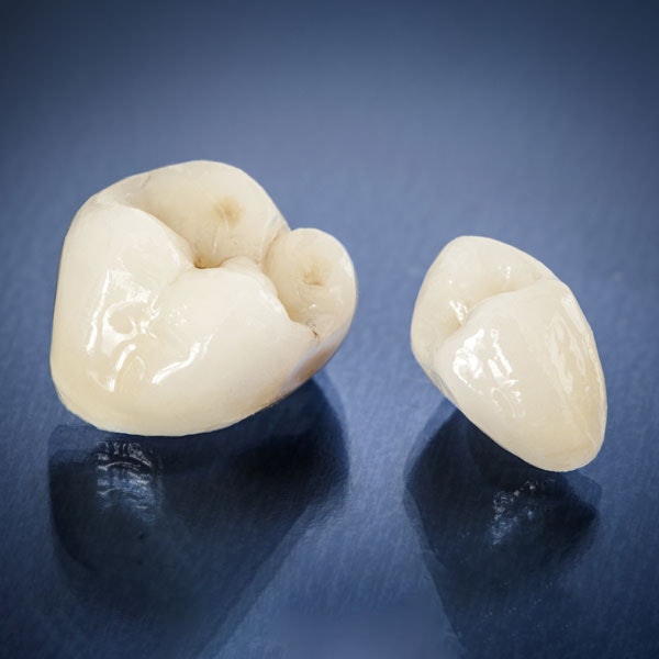 Dental crowns