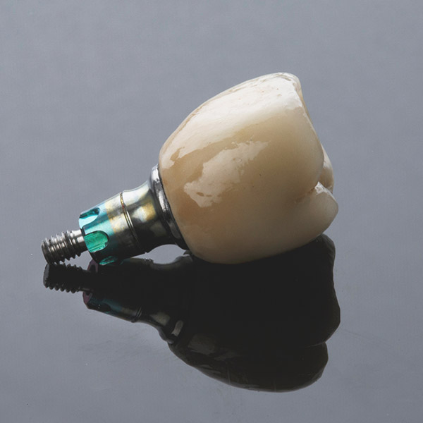 Implant-supported crown