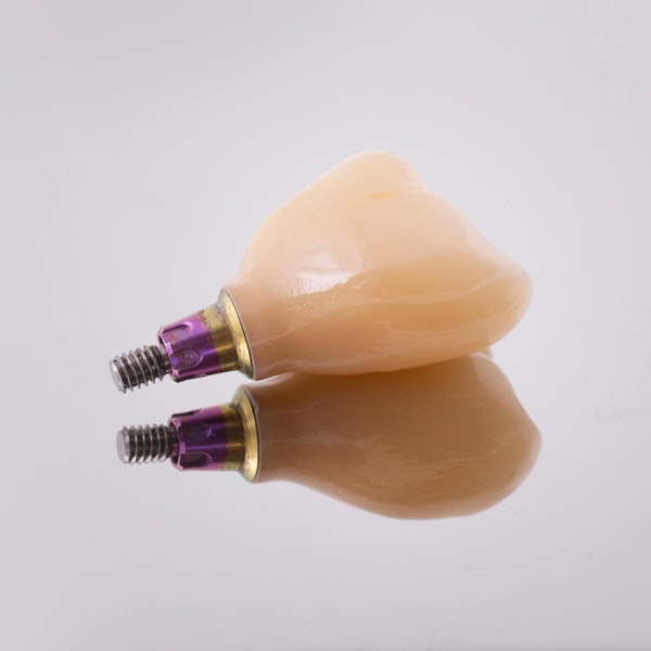 dental crown on an implant