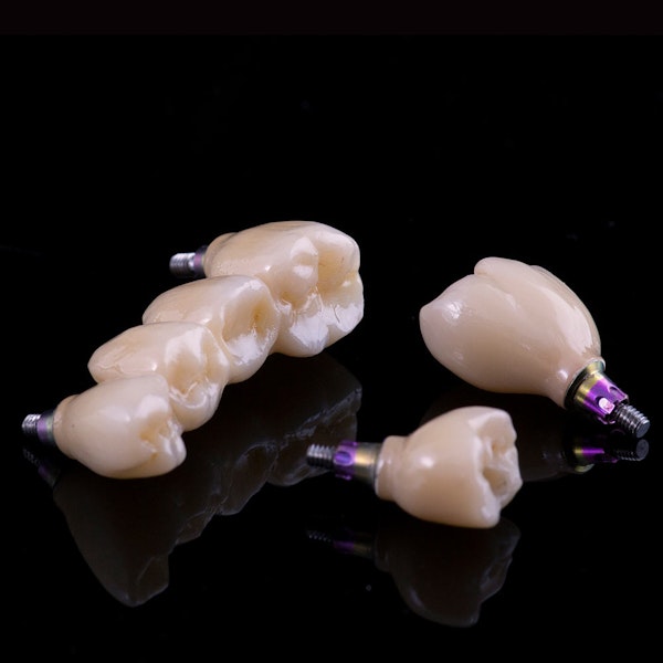 Dental implants