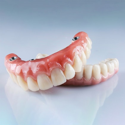 implant-supported dentures