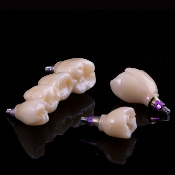 Dental implants