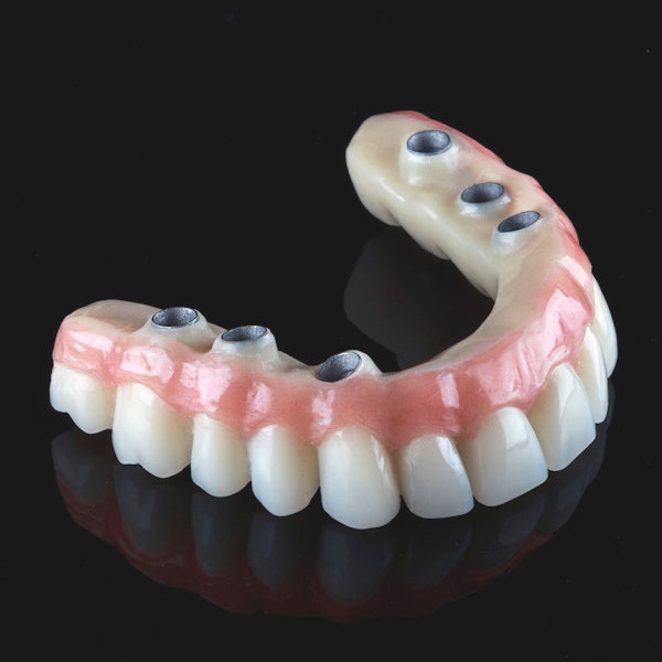 Denture implants