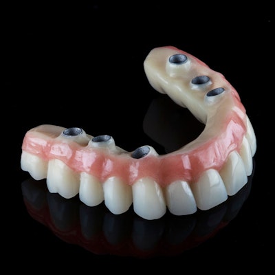 All-on-6 denture