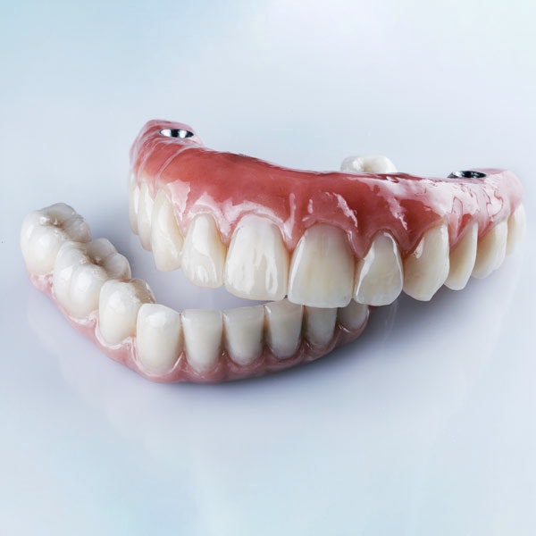 Implant dentures