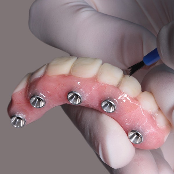 ​Implant-Supported Dentures