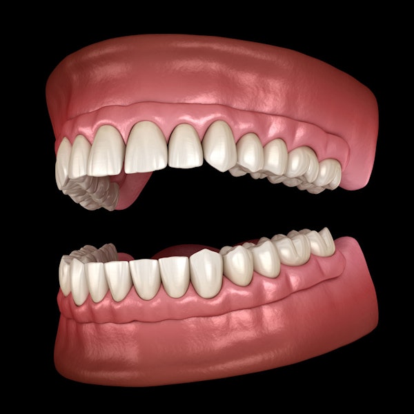 Dentures