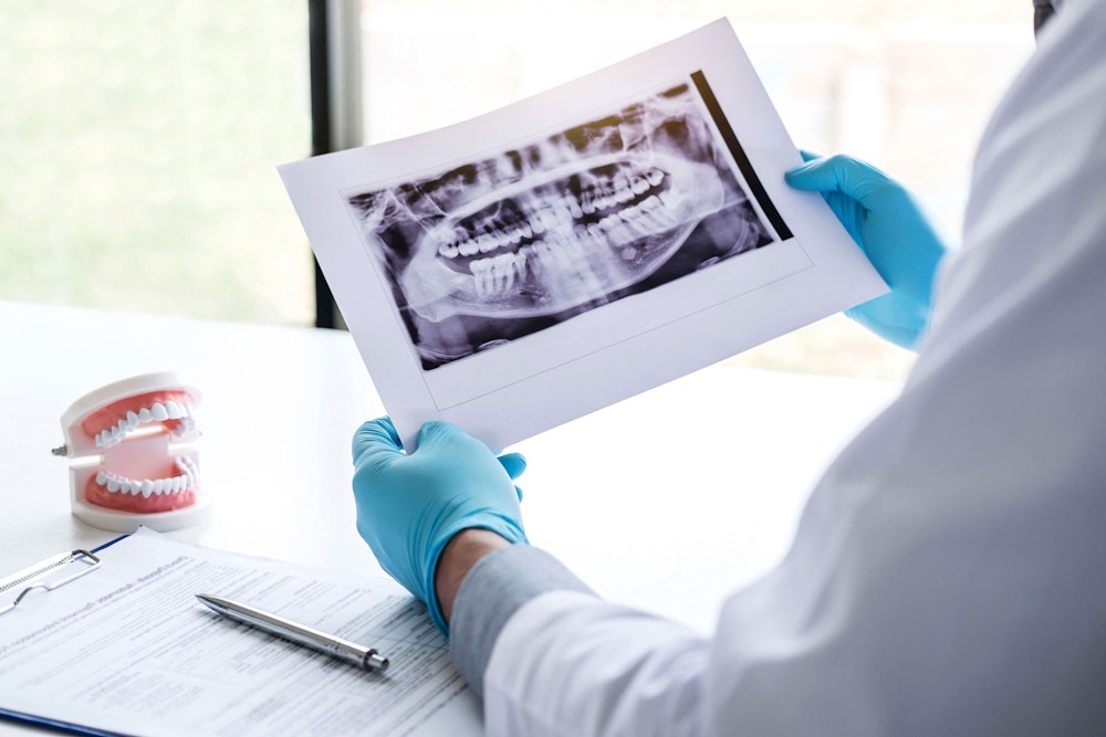 dentist examining x-rays of a patient's mouth