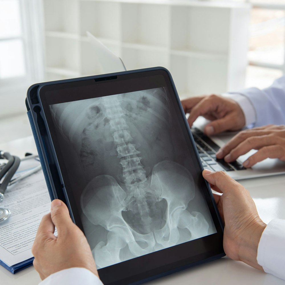 Doctor examining x-ray