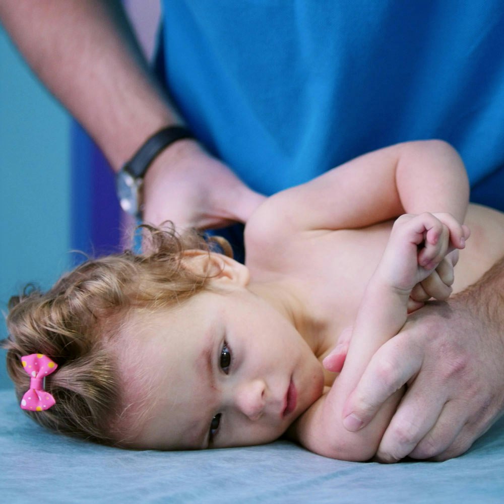 Baby with Erb's palsy