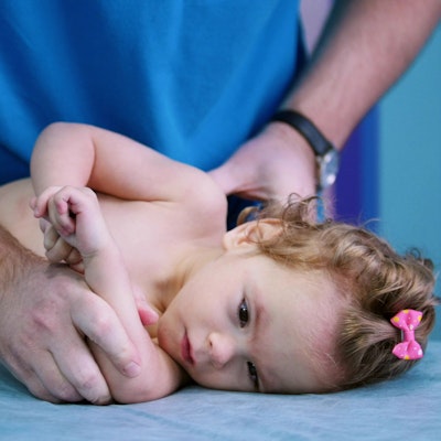 Baby with Erb's Palsy at occupational therapy appointment