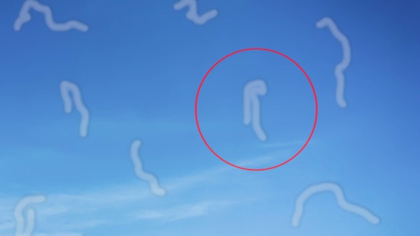 Eye floaters circled by a red line