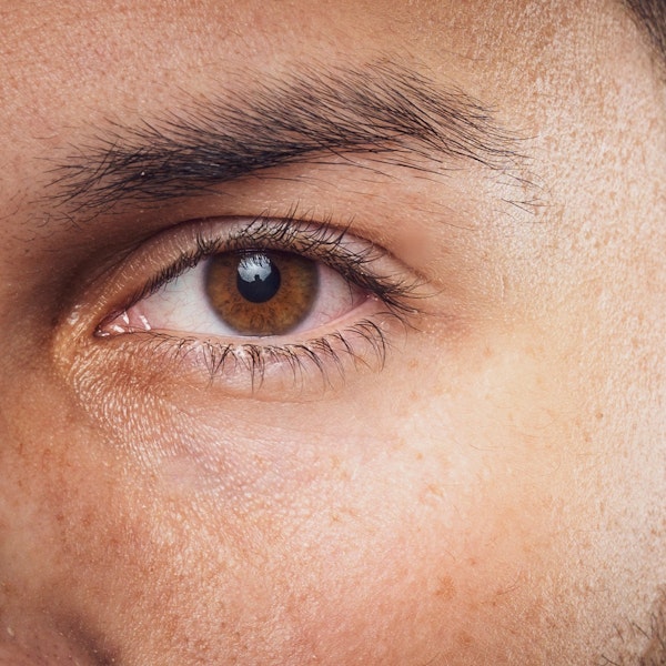 Close up of blepharoplasty