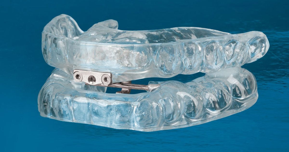 Sleep apnea mouthpiece