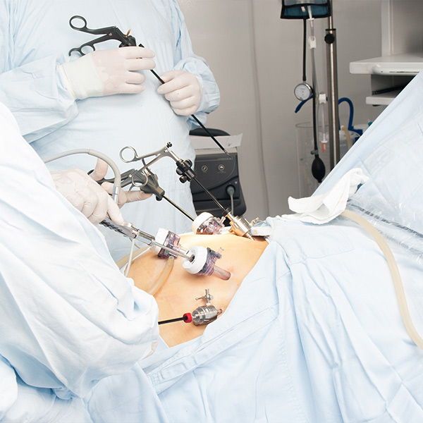Abdominal surgery
