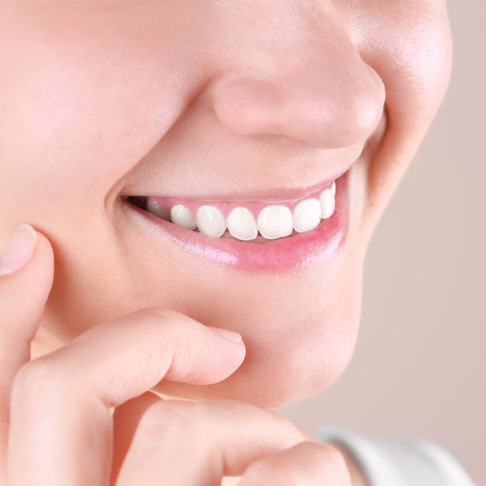 Woman with too little teeth and long gumline