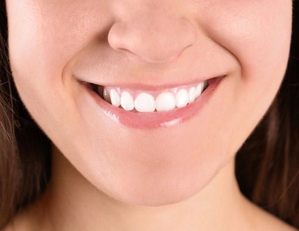 Gummy smile up close