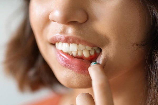 Woman looking at inflamed gums