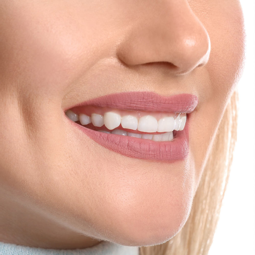 Gummy Smile (Laser Gum Contouring / Botox) - Gentle Smile Dental