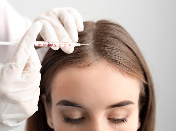 Woman receiving hair loss treatment
