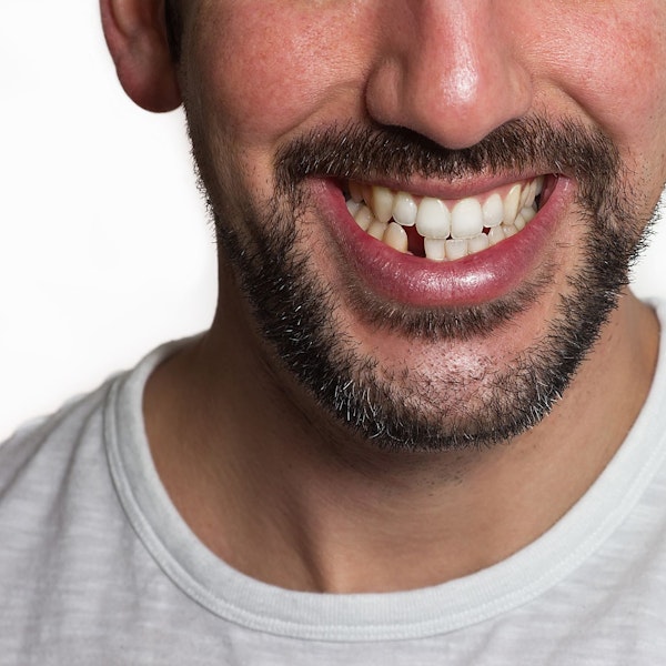 Person missing one tooth