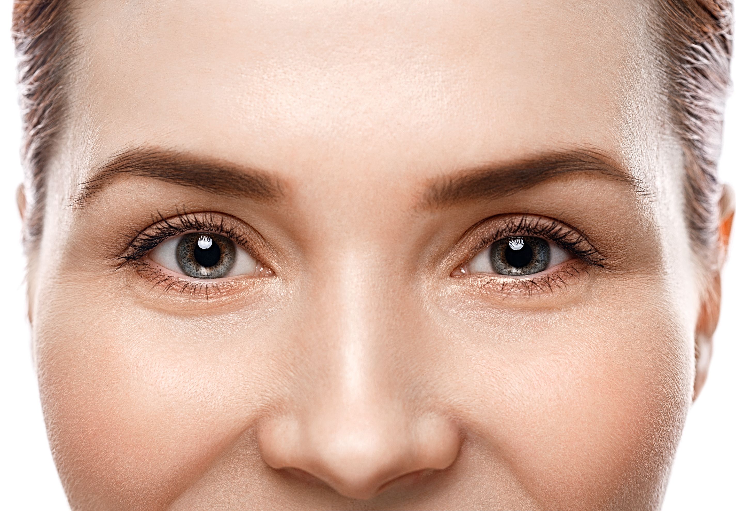 Brow and forehead lift patient
