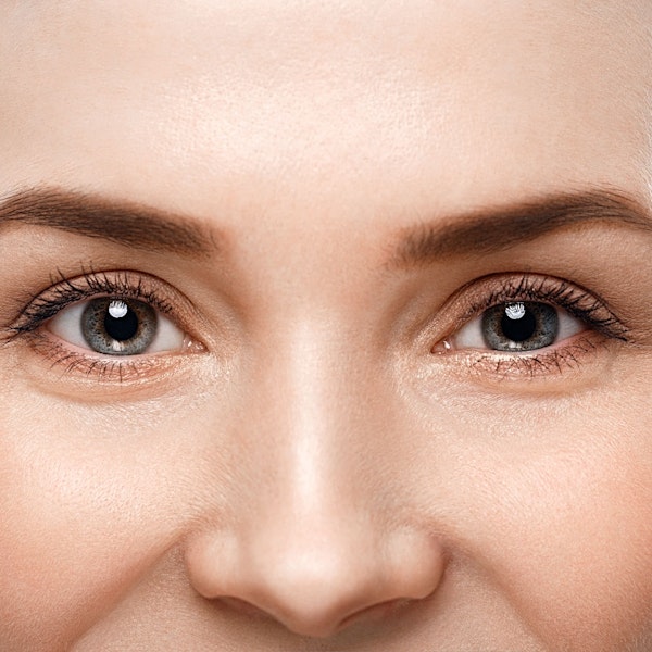 Brow and forehead lift patient