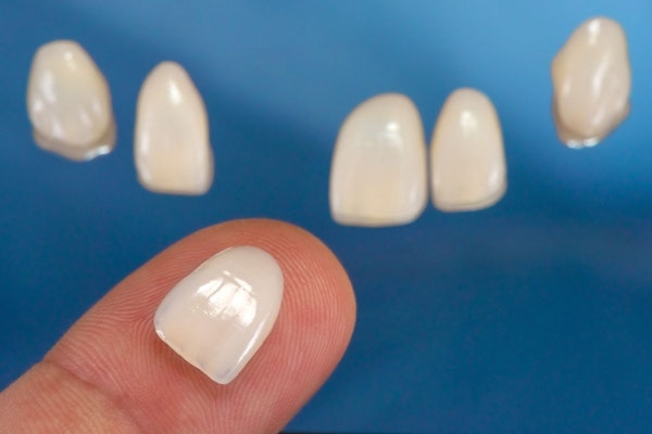 Dental veneer resting on a fingertip