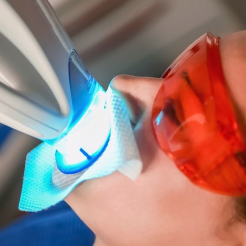 Patient in dental chair with specialized light directed toward teeth