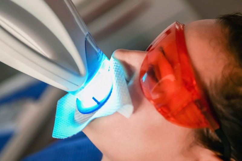 A patient undergoing Philips Zoom!® in-office teeth whitening treatment