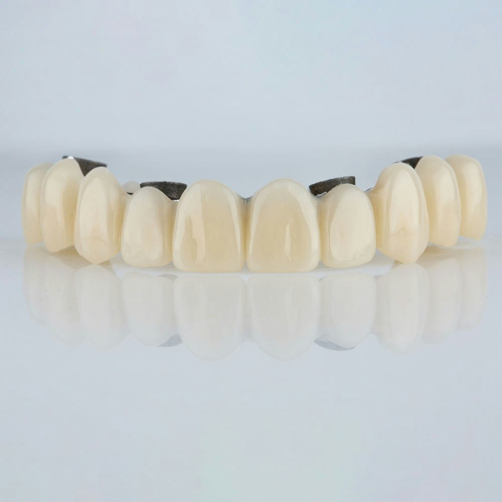 immediate load implants