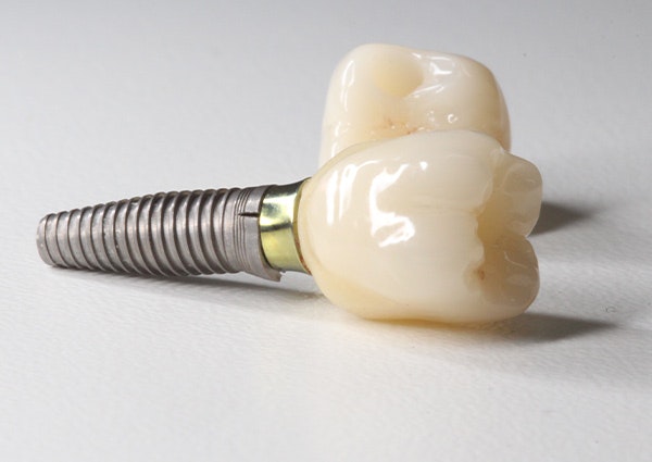 Dental implant crowns