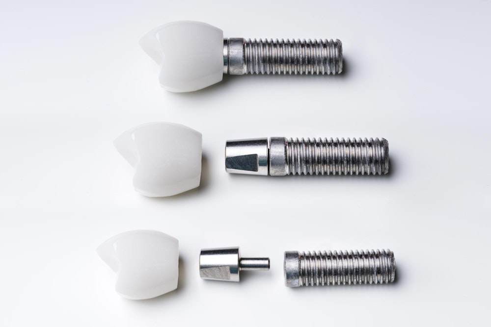Dental implants