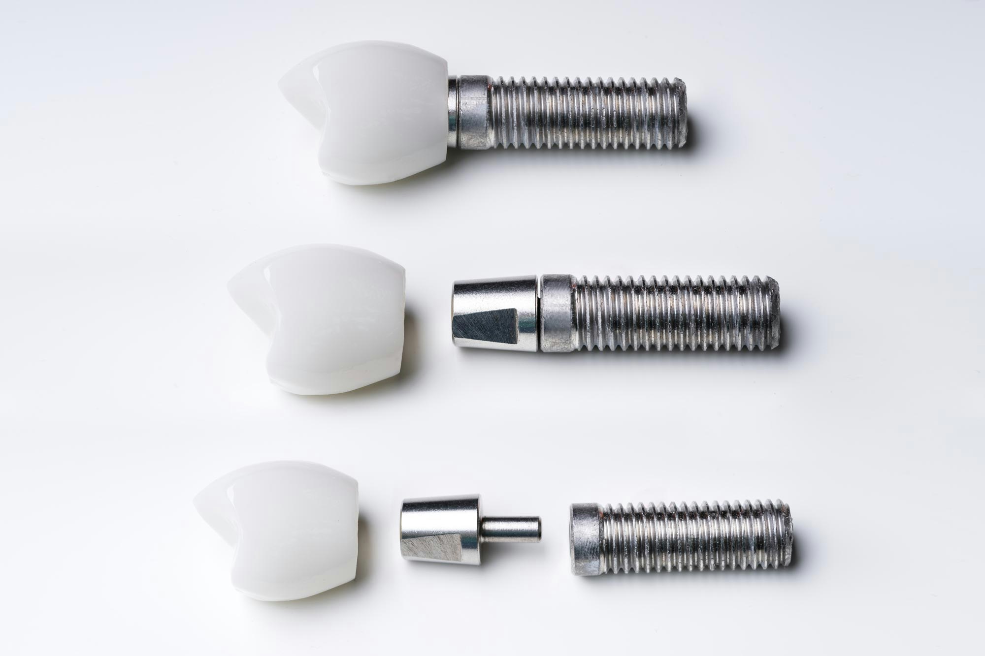 Dental implants