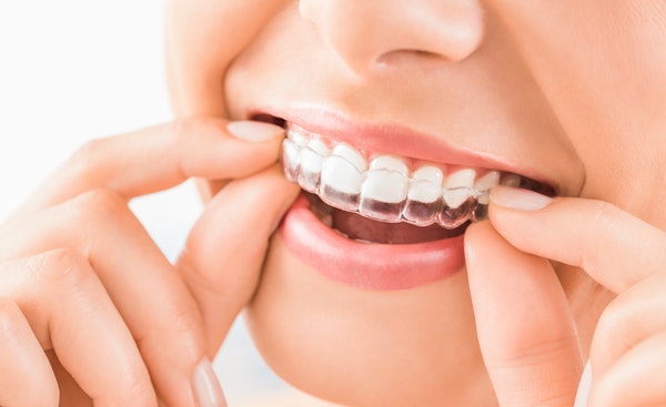 Close up of woman putting on Invisalign Express