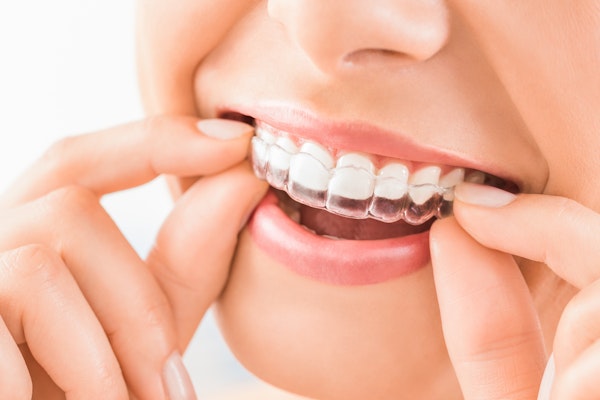 Close up of woman putting on Invisalign Express