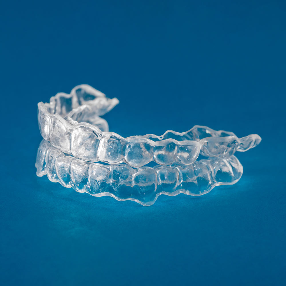 Invisalign® aligner