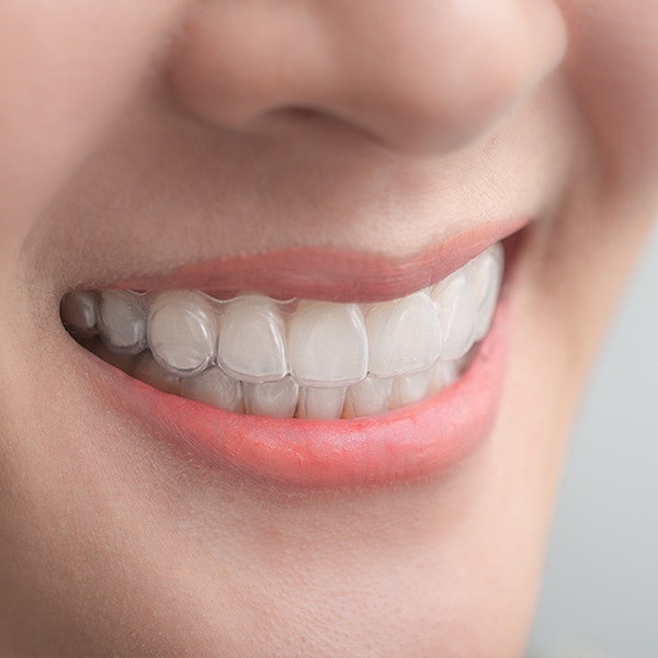 Dental Questions: Can I eat with my Invisalign trays on?