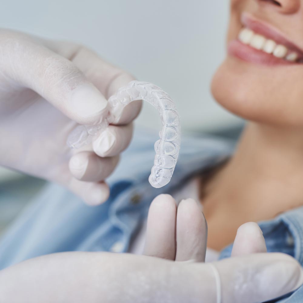 Illustration of Invisalign tray