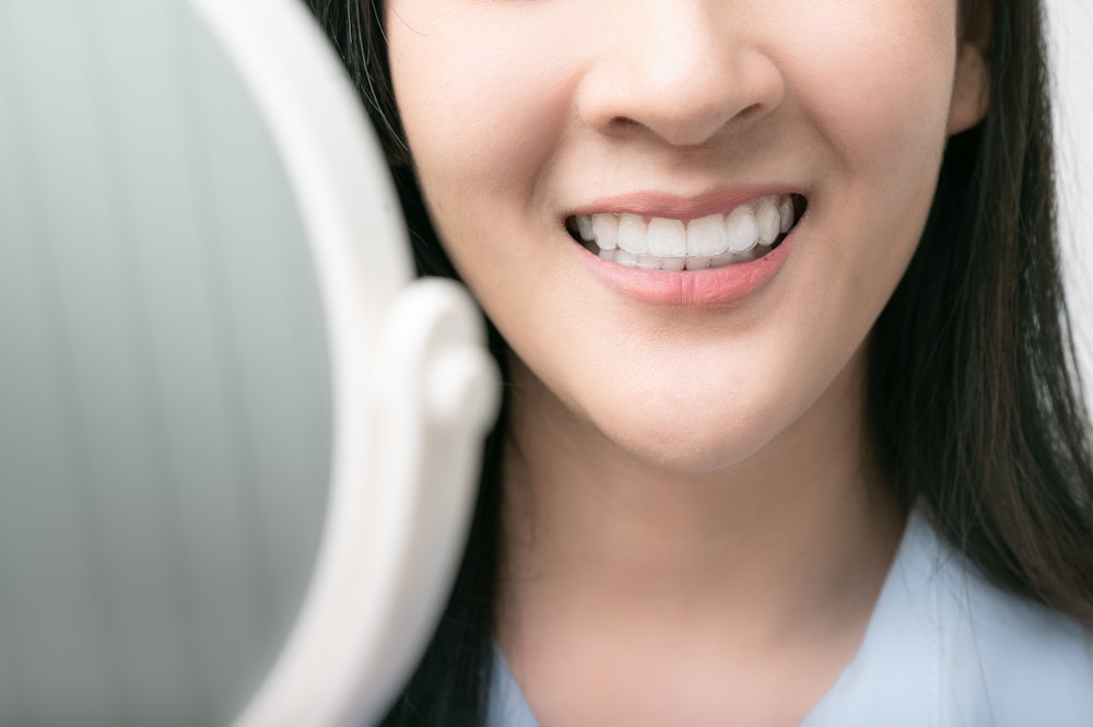 Woman wearing invisalign