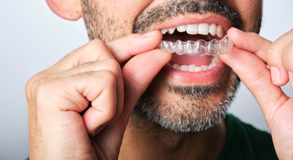 man putting in invisalign aligners