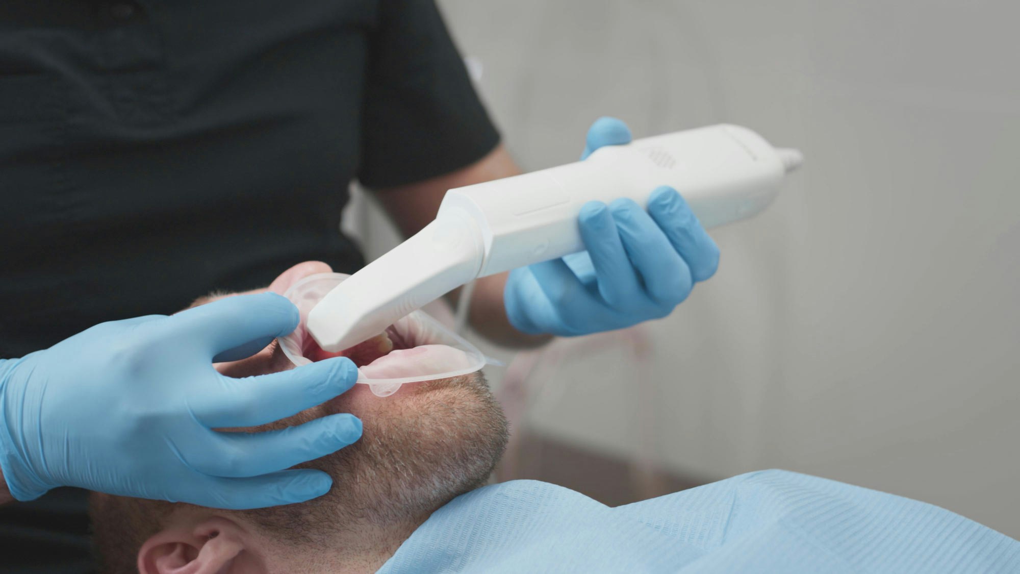 Cadent iTero 3-D Intraoral Scanner Photo